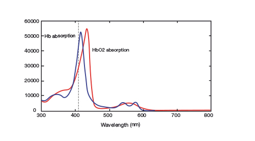 Monocrom laser cancer graph2