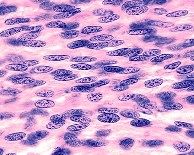 Fibroplast plasma monocrom img2