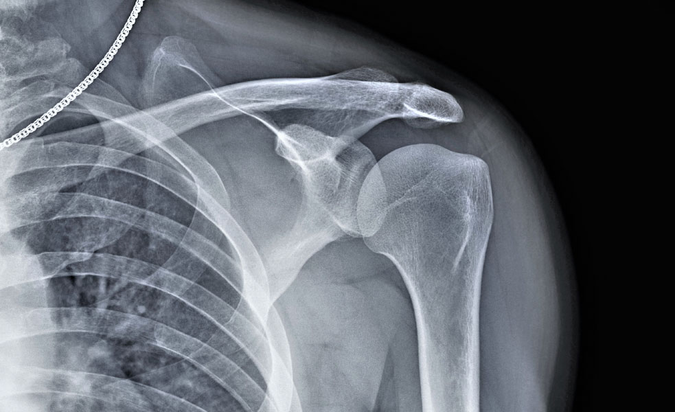 Laser imaging applications - x-ray